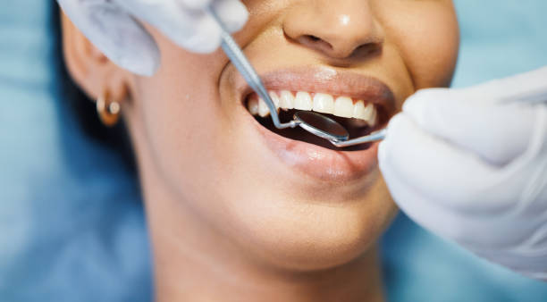 Best Emergency Denture Repair in Finneytown, OH